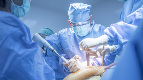 Orthopedic surgeon performing a surgical procedure