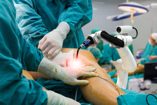 Robotic technology used during knee replacement procedure